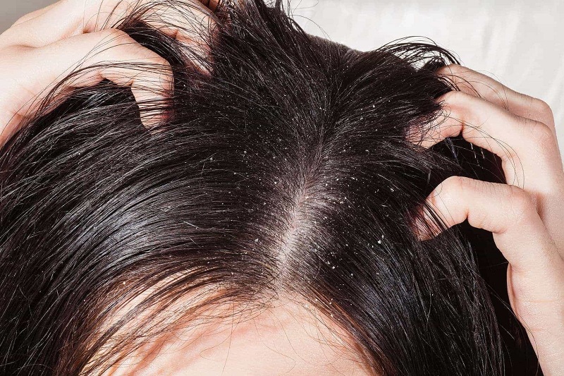 Tips sử dụng tóc giả nguyên đầu mỗi ngày thoải mái nhất  Tóc giả Naki Queen
