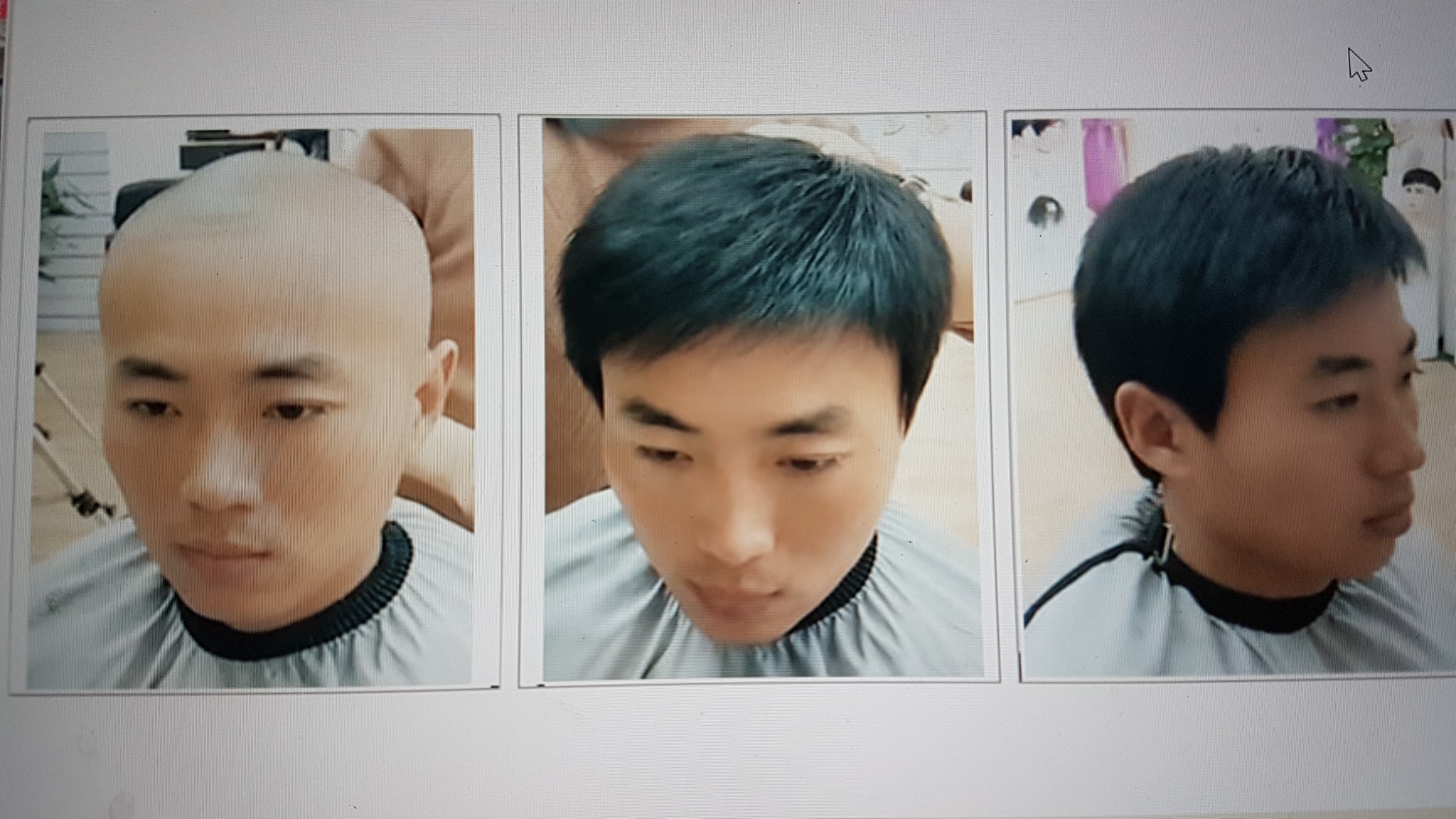 Địa chỉ tóc giả che bạc che hói uy tín cho nam giới - #1 Tóc Giả Đẹp từ tóc  thật tại Hà Nội | Dream Hair
