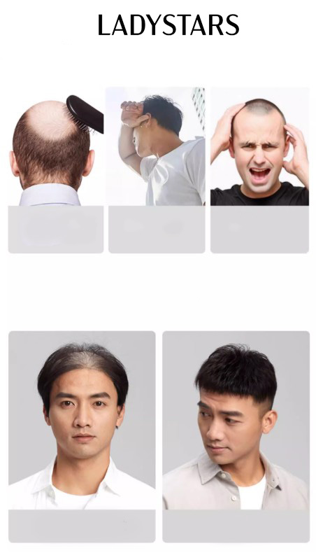 Ưu điểm khi sử dụng tóc giả Mohican