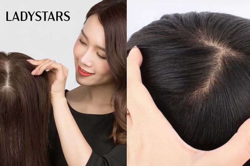 Cách đội tóc giả siêu da đầu hạn chế rụng tóc